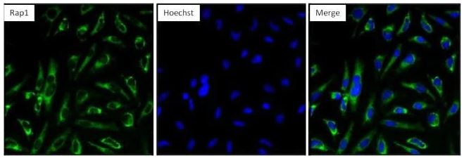 Immunocytochemistry/ Immunofluorescence - Anti-RAP1A antibody [1D2-1C64] (AB175329)