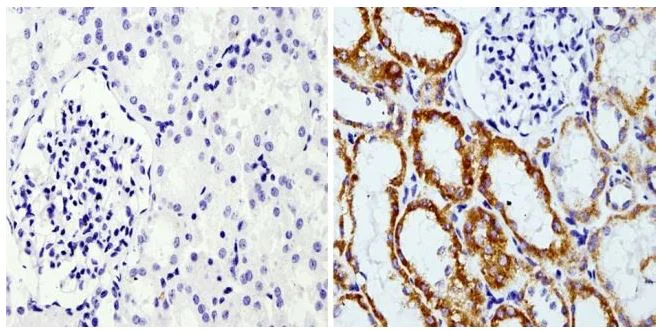 Immunohistochemistry (Formalin/PFA-fixed paraffin-embedded sections) - Anti-RAP1A antibody [1D2-1C64] (AB175329)