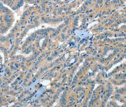 Immunohistochemistry (Formalin/PFA-fixed paraffin-embedded sections) - Anti-RAP1A antibody (AB197673)