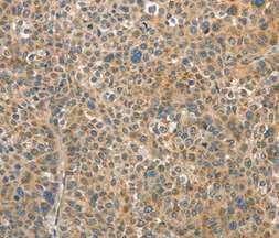 Immunohistochemistry (Formalin/PFA-fixed paraffin-embedded sections) - Anti-RAP1A antibody (AB197673)