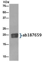 Immunoprecipitation - Anti-RAP1A + RAP1B antibody [EPR14814] (AB187659), expandable thumbnail
