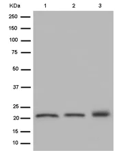Western blot - Anti-RAP1A + RAP1B antibody [EPR14814] (AB187659)
