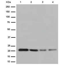 Western blot - Anti-RAP1A + RAP1B antibody [EPR14814] (AB187659)