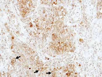 Immunohistochemistry (Formalin/PFA-fixed paraffin-embedded sections) - Anti-RAP1B antibody (AB154756)