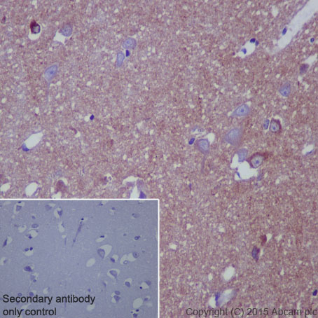 Immunohistochemistry (Formalin/PFA-fixed paraffin-embedded sections) - Anti-RAP1GAP antibody [Y134] (AB32373), expandable thumbnail