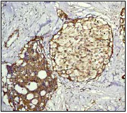 Immunohistochemistry (Formalin/PFA-fixed paraffin-embedded sections) - Anti-RAP1GAP antibody [Y134] (AB32373)