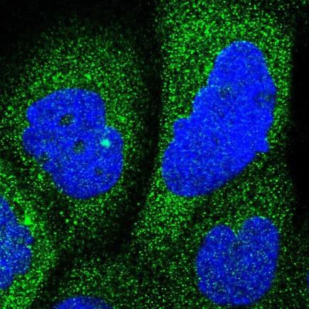 Immunocytochemistry/ Immunofluorescence - Anti-RAP1GDS1 antibody (AB224413)