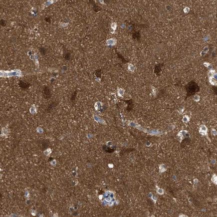 Immunohistochemistry (Formalin/PFA-fixed paraffin-embedded sections) - Anti-RAP1GDS1 antibody (AB224413)