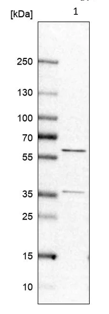 Western blot - Anti-RAP1GDS1 antibody (AB224413)
