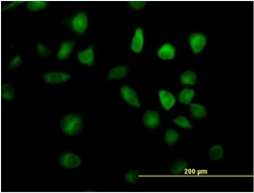 Immunocytochemistry/ Immunofluorescence - Anti-RAP1GDS1 antibody (AB67722)