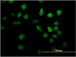 Immunocytochemistry/ Immunofluorescence - Anti-RAP1GDS1 antibody (AB67722)