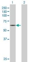 Western blot - Anti-RAP1GDS1 antibody (AB67722)