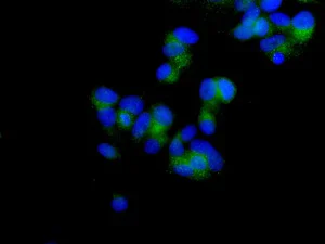 Immunocytochemistry/ Immunofluorescence - Anti-Rap2A+Rap2B+Rap2C antibody [EPR12825(B)] (AB173296)