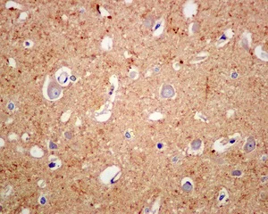 Immunohistochemistry (Formalin/PFA-fixed paraffin-embedded sections) - Anti-Rap2A+Rap2B+Rap2C antibody [EPR12825(B)] (AB173296)