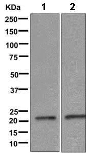 Western blot - Anti-Rap2A+Rap2B+Rap2C antibody [EPR12825(B)] (AB173296)