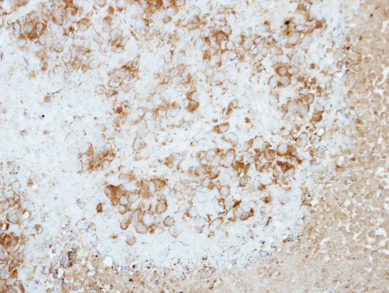 Immunohistochemistry (Formalin/PFA-fixed paraffin-embedded sections) - Anti-RAP2B antibody (AB101369)