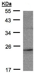 Western blot - Anti-RAP2C antibody (AB97805)