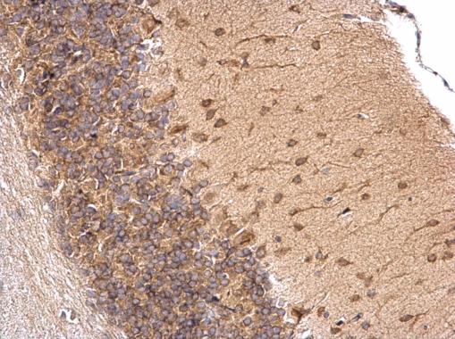 Immunohistochemistry (Formalin/PFA-fixed paraffin-embedded sections) - Anti-RAP55 antibody (AB229277), expandable thumbnail