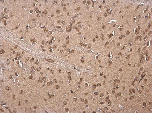 Immunohistochemistry (Formalin/PFA-fixed paraffin-embedded sections) - Anti-RAP55 antibody (AB229277), expandable thumbnail