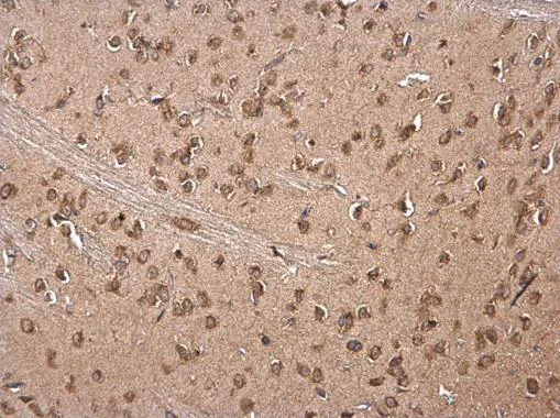 Immunohistochemistry (Formalin/PFA-fixed paraffin-embedded sections) - Anti-RAP55 antibody (AB229277)
