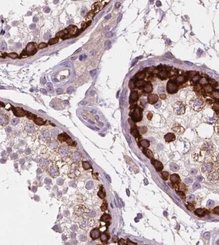 Immunohistochemistry (Formalin/PFA-fixed paraffin-embedded sections) - Anti-RAP55B antibody (AB221041)