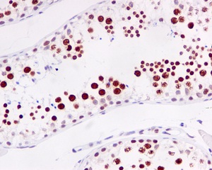 Anti-RAP80 antibody [EPR5315]
