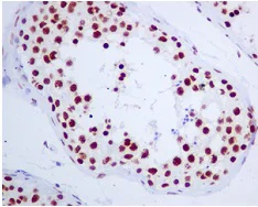 Immunohistochemistry (Formalin/PFA-fixed paraffin-embedded sections) - Anti-RAPGEF5 antibody [EPR6882] (AB129008)
