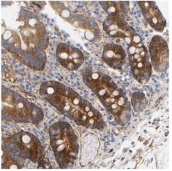 Immunohistochemistry (Formalin/PFA-fixed paraffin-embedded sections) - Anti-RAPH1 antibody (AB121619), expandable thumbnail