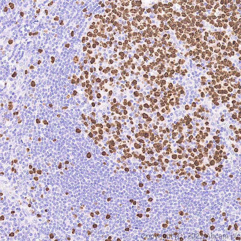 Immunohistochemistry (Formalin/PFA-fixed paraffin-embedded sections) - Rapid DAB Detection System (AB290116)