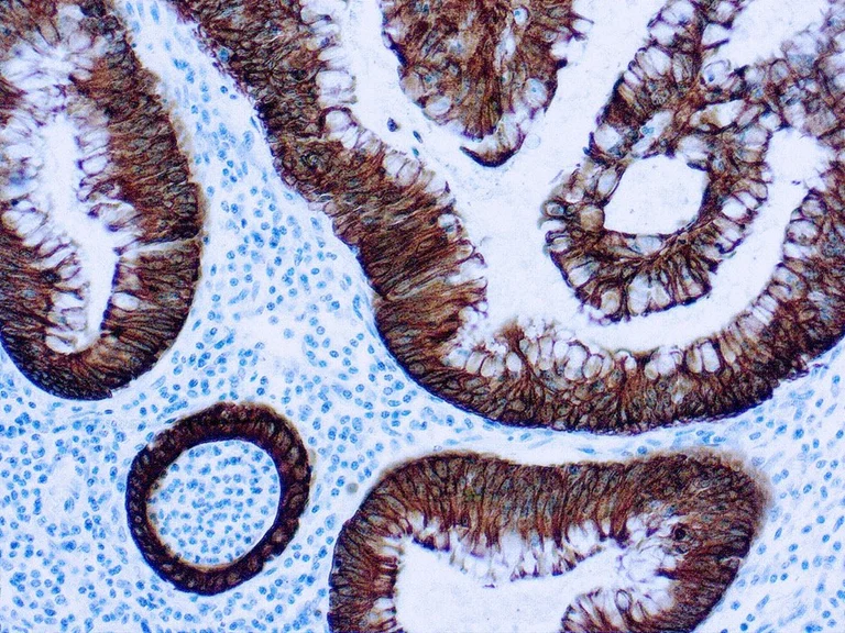 Immunohistochemistry - Rapid DAB Detection System (AB290116)