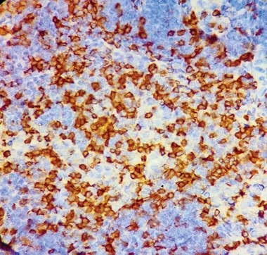 Immunohistochemistry - Rapid DAB Detection System (AB290116)