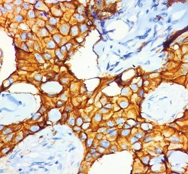 Immunohistochemistry - Rapid DAB Detection System (AB290116)