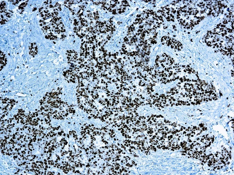 Immunohistochemistry - Rapid DAB Detection System (AB290116)