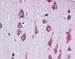 Immunohistochemistry (Formalin/PFA-fixed paraffin-embedded sections) - Anti-Rapsyn antibody (AB118491)