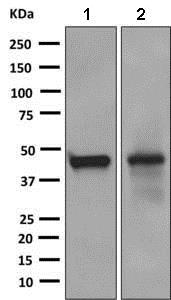 Western blot - Anti-Rapsyn antibody [EPR9759] (AB156002)