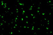 Immunocytochemistry/ Immunofluorescence - Anti-Raptor antibody (AB26264)
