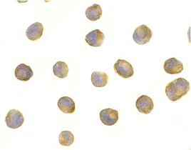 Immunocytochemistry - Anti-Raptor antibody (AB62454)