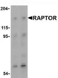 Western blot - Anti-Raptor antibody (AB62454)