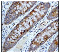 Immunohistochemistry (Formalin/PFA-fixed paraffin-embedded sections) - Anti-Raptor antibody [EP539Y] - BSA and Azide free (AB239827)