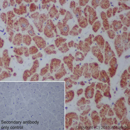 Immunohistochemistry (Formalin/PFA-fixed paraffin-embedded sections) - Anti-Raptor antibody [EP539Y] - BSA and Azide free (AB239827)
