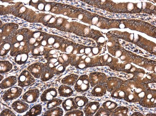 Anti-Raptor antibody - N-terminal (ab226824) | Abcam
