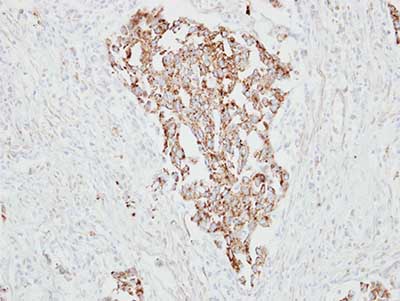 Immunohistochemistry (Formalin/PFA-fixed paraffin-embedded sections) - Anti-RARRES1 antibody (AB154742)