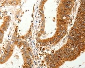 Immunohistochemistry (Formalin/PFA-fixed paraffin-embedded sections) - Anti-RARRES1 antibody (AB198908), expandable thumbnail