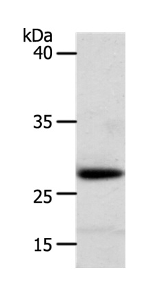 Western blot - Anti-RARRES1 antibody (AB198908), expandable thumbnail
