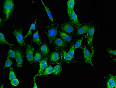 Immunocytochemistry/ Immunofluorescence - Anti-RARS antibody (AB236788), expandable thumbnail
