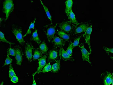 Immunocytochemistry/ Immunofluorescence - Anti-RARS antibody (AB236788)