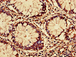 Immunohistochemistry (Formalin/PFA-fixed paraffin-embedded sections) - Anti-RARS antibody (AB236788), expandable thumbnail