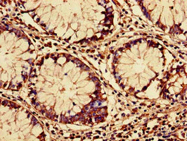 Immunohistochemistry (Formalin/PFA-fixed paraffin-embedded sections) - Anti-RARS antibody (AB236788)