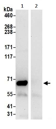 Immunoprecipitation - Anti-RARS antibody (AB241085)