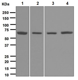 Western blot - Anti-RARS antibody [EPR6298] (AB128956), expandable thumbnail